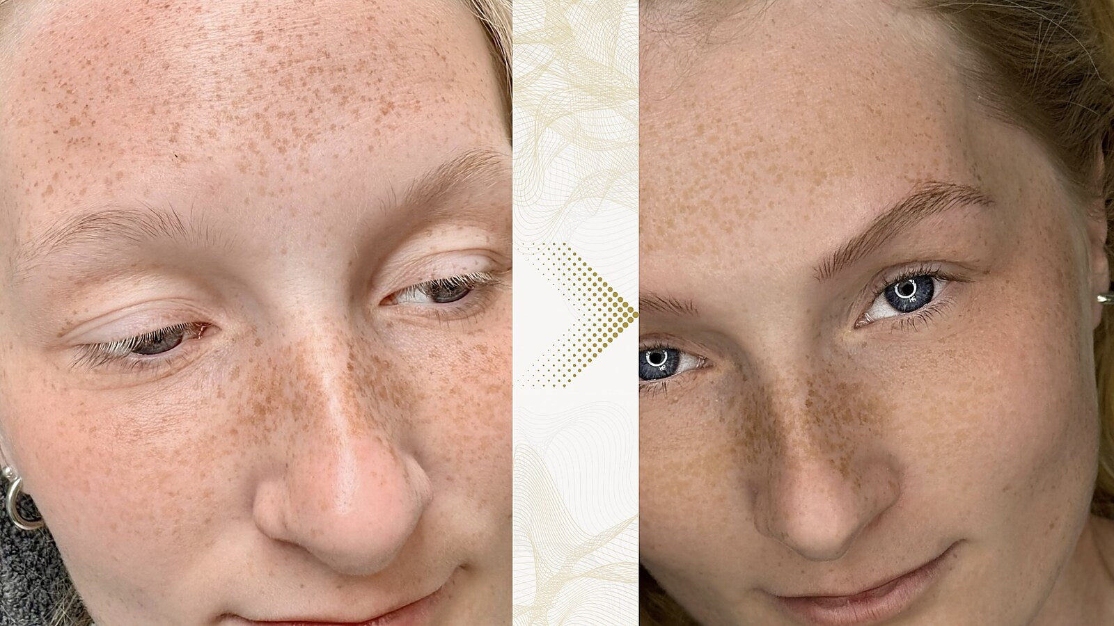 Augenbraue vor und nach der Hairstroke-Behandlung: Hellblonde Augenbrauen.