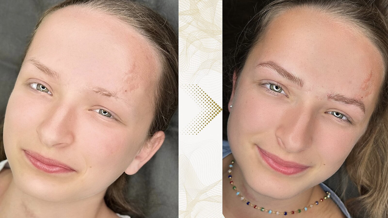 Augenbraue vor und nach der Hairstroke-Behandlung: Unvollständige Augenbrauen.